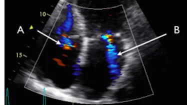 Advanced Cardiac Ultrasound (FATE) course image